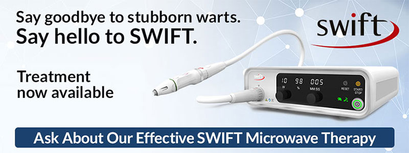 SWIFT for Plantar Warts